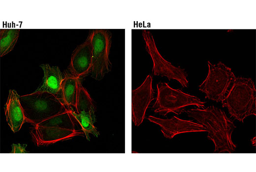 Immunofluorescence Image 2: FABP1 (D2A3X) XP® Rabbit mAb