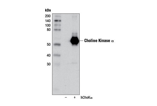 Western Blotting Image 2: Choline Kinase α (D5X9W) Rabbit mAb