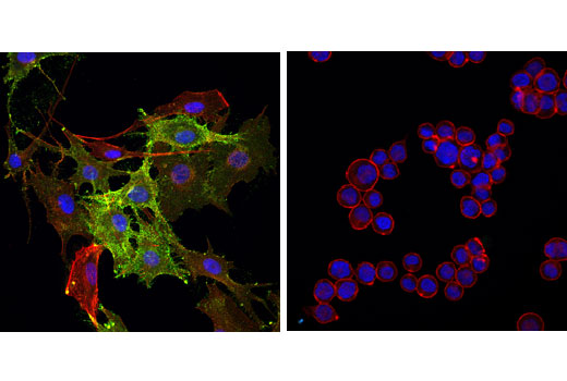 Immunofluorescence Image 1: MCAM (P1H12) Mouse mAb