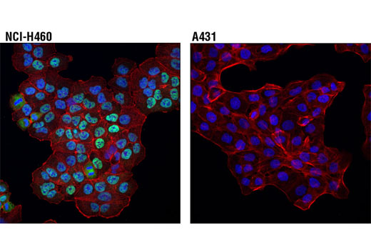 Immunofluorescence Image 1: DAX1 (D2F1) Rabbit mAb