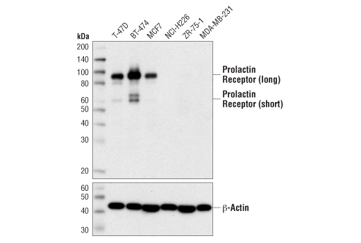 Western Blotting Image 1: Prolactin Receptor (D4A9) Rabbit mAb