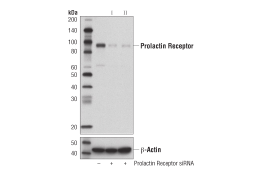 Western Blotting Image 2: Prolactin Receptor (D4A9) Rabbit mAb