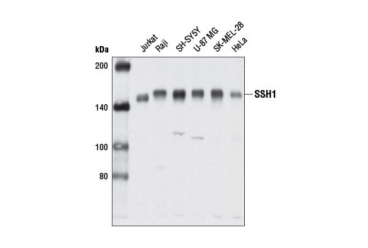  Image 3: Cofilin Activation Antibody Sampler Kit