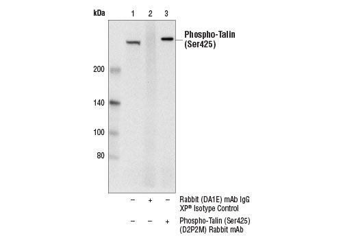 Immunoprecipitation Image 1: Phospho-Talin (Ser425) (D2P2M) Rabbit mAb