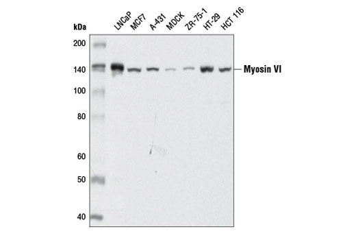 Western Blotting Image 1: Myosin VI (D5Y5A) Rabbit mAb