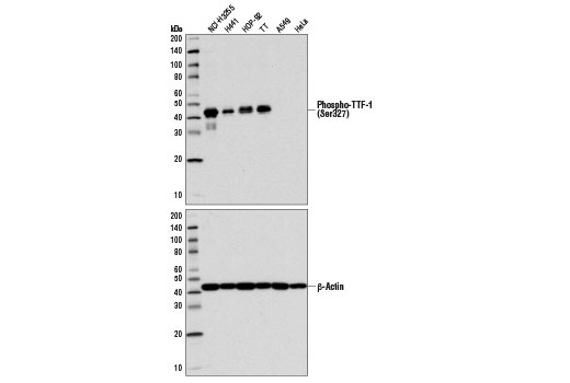 Western Blotting Image 1: Phospho-TTF-1 (Ser327) Antibody