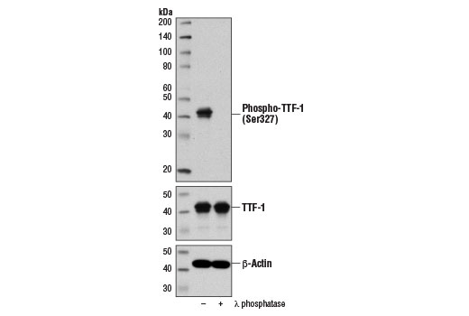Western Blotting Image 2: Phospho-TTF-1 (Ser327) Antibody