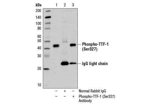 Immunoprecipitation Image 1: Phospho-TTF-1 (Ser327) Antibody