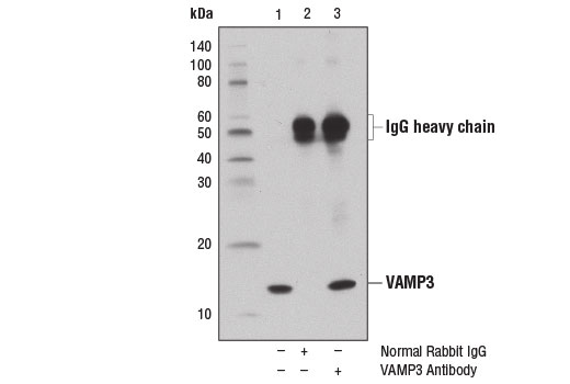 Immunoprecipitation Image 1: VAMP3 Antibody