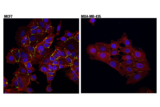 Immunofluorescence Image 1: ZO-1 (D6L1E) Rabbit mAb