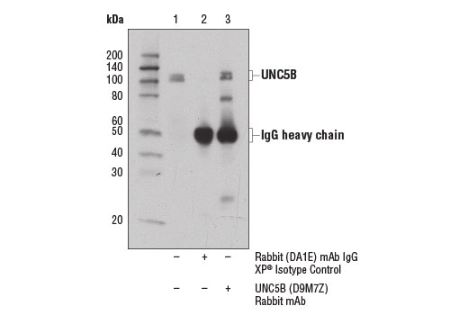 Immunoprecipitation Image 1: UNC5B (D9M7Z) Rabbit mAb