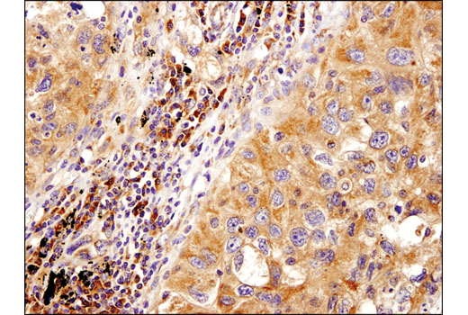 Immunohistochemistry Image 2: PLD2 (E1Y9L) Rabbit mAb