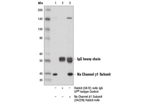 Immunoprecipitation Image 1: Na Channel β1 Subunit (D4Z2N) Rabbit mAb