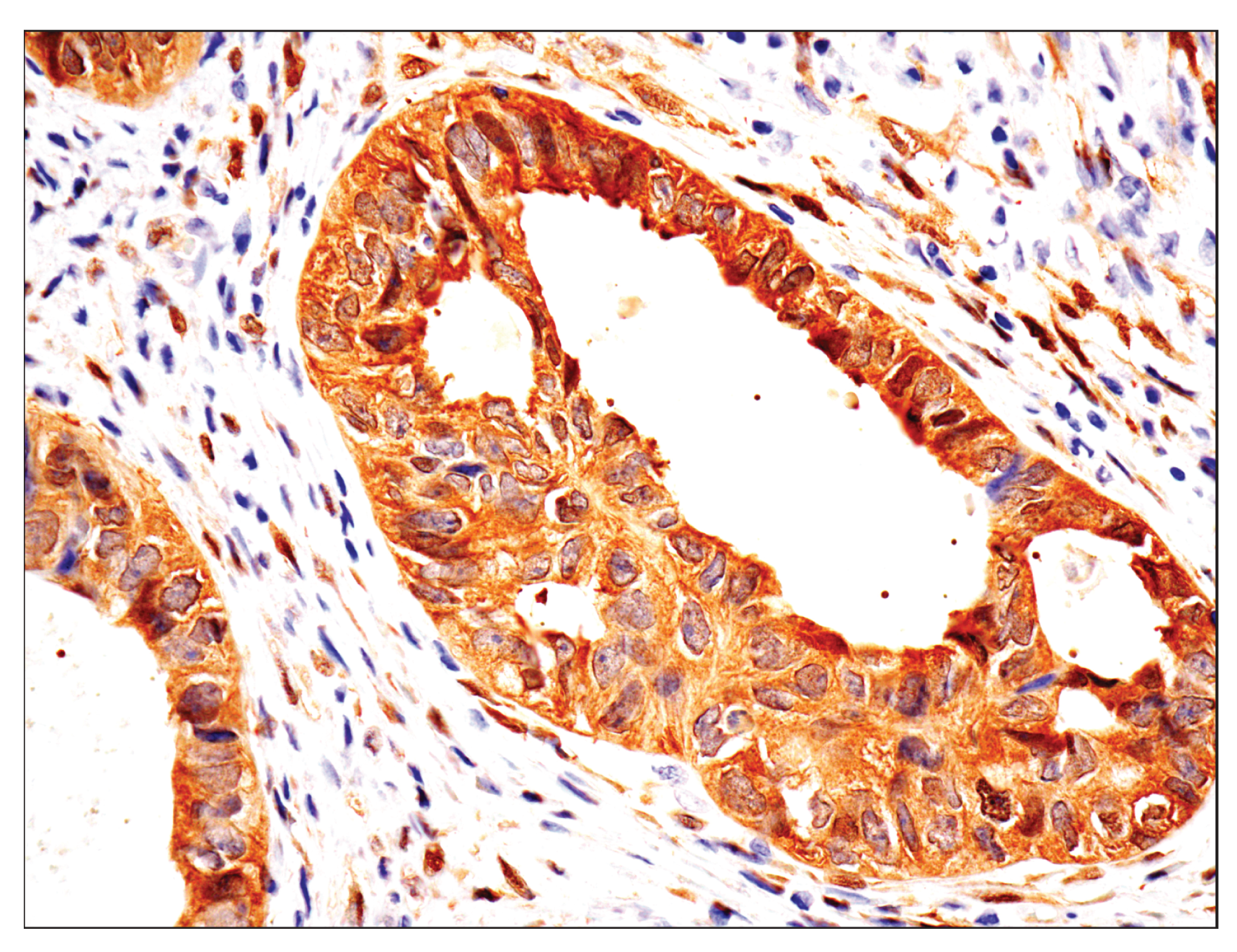 Image 48: Small Cell Lung Cancer Biomarker Antibody Sampler Kit