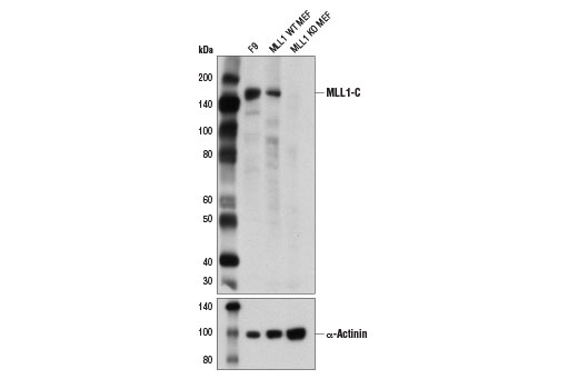 Western Blotting Image 1: MLL1 (D6G8N) Rabbit mAb (Carboxy-terminal Antigen)