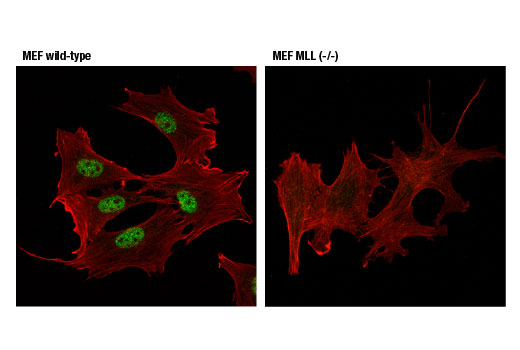 Immunofluorescence Image 1: MLL1 (D6G8N) Rabbit mAb (Carboxy-terminal Antigen)