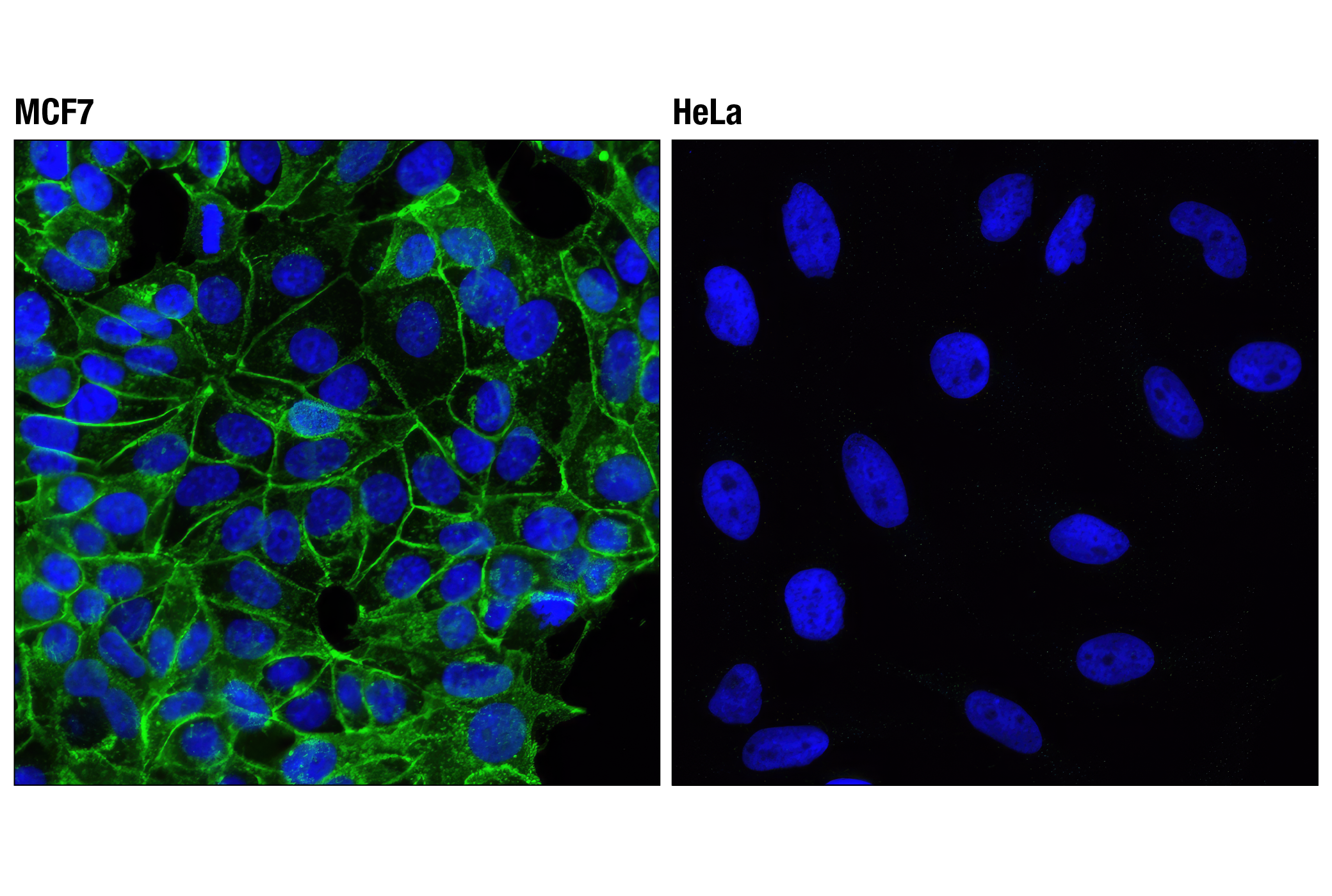Immunofluorescence Image 1: E-Cadherin (4A2) Mouse mAb