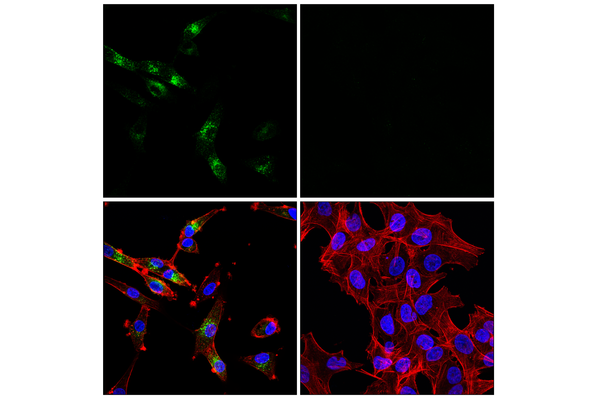 Immunofluorescence Image 2: EAAT3 (E1E6M) Rabbit mAb