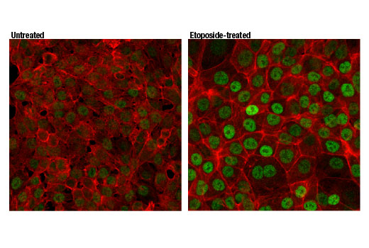 Immunofluorescence Image 1: p73 (D3G10) Rabbit mAb