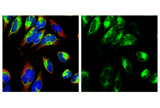 Immunofluorescence Image 1: Sec61B (D5Q1W) Rabbit mAb