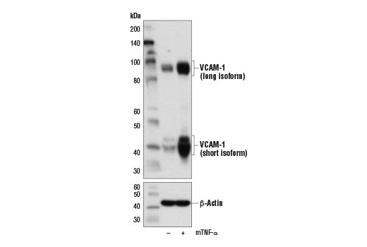 Western Blotting Image 1: VCAM-1 Antibody