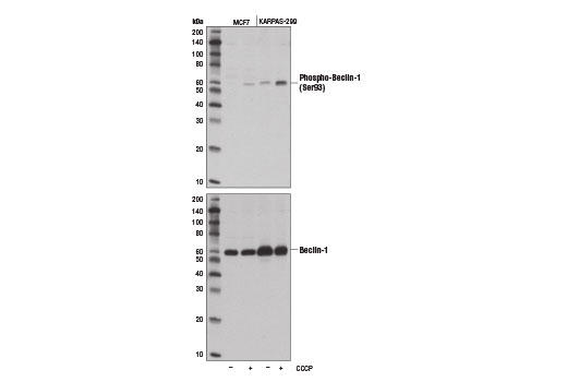  Image 6: AMPK Substrate Antibody Sampler Kit