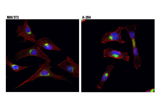 Immunofluorescence Image 1: Vti1a (D8U3M) Rabbit mAb