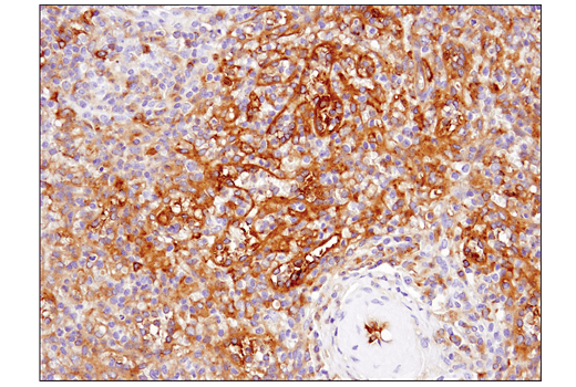 Immunohistochemistry Image 5: IFIT1 (D2X9Z) Rabbit mAb