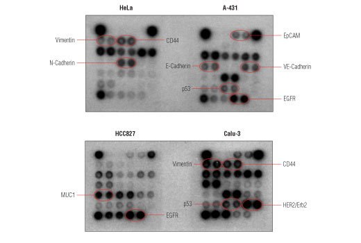  Image 2: PathScan® Cancer Phenotype Antibody Array Kit (Chemiluminescent Readout)