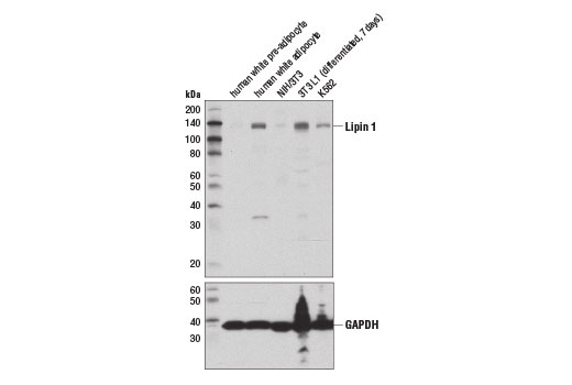  Image 3: Fatty Acid and Lipid Metabolism Antibody Sampler Kit