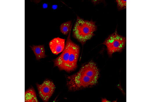 Immunofluorescence Image 1: Lipin 1 (D2W9G) Rabbit mAb