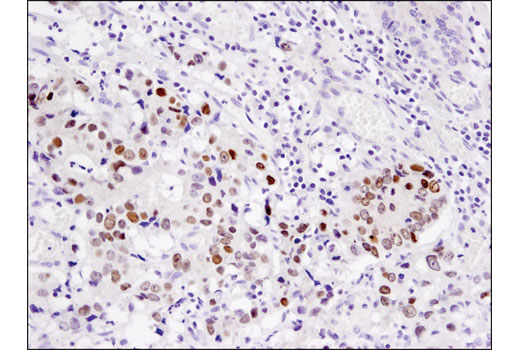 Immunohistochemistry Image 1: PROX1 (D2J6J) Rabbit mAb