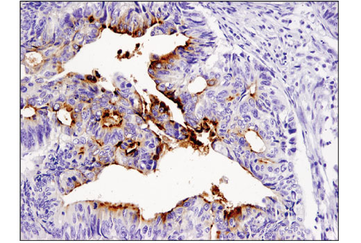 Immunohistochemistry Image 2: TIM-1 (E1R9N) Rabbit mAb (BSA and Azide Free)