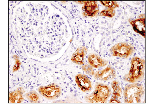 Immunohistochemistry Image 1: TIM-1 (E1R9N) Rabbit mAb (BSA and Azide Free)