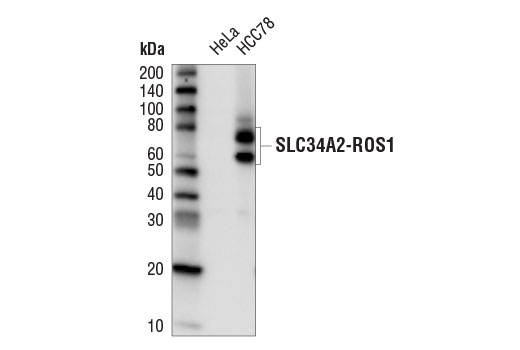 Western Blotting Image 1: ROS1 (D4D6®) Rabbit mAb (HRP Conjugate)