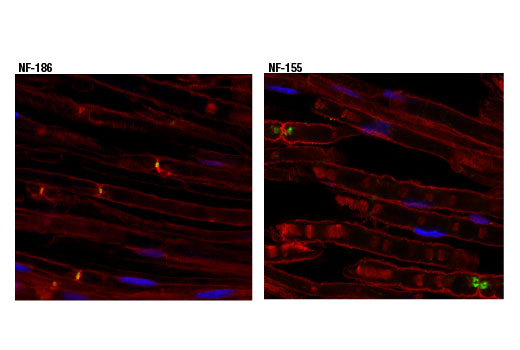 Immunofluorescence Image 1: Neurofascin 155 (D7B6O) Rabbit mAb