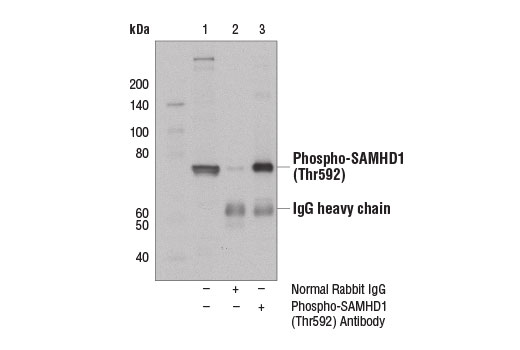 Immunoprecipitation Image 1: Phospho-SAMHD1 (Thr592) Antibody