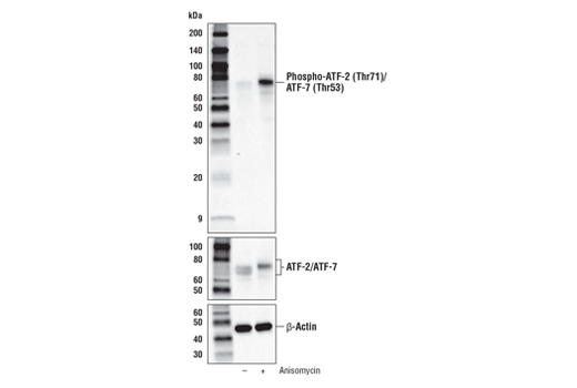  Image 2: Phospho-SAPK/JNK Pathway Antibody Sampler Kit