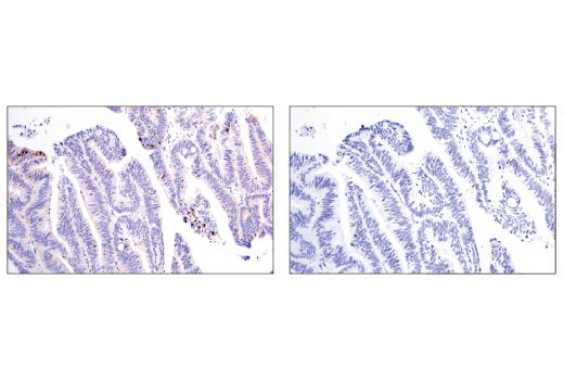 Immunohistochemistry Image 2: Phospho-SQSTM1/p62 (Ser349) (E7M1A) Rabbit mAb