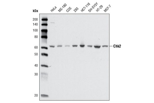 Western Blotting Image 2: Chk2 (1C12) Mouse mAb (BSA and Azide Free)