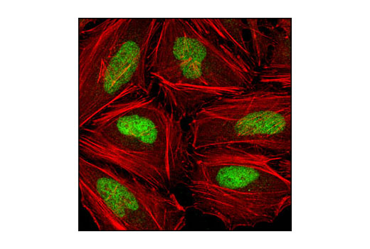 Immunofluorescence Image 1: Chk2 (1C12) Mouse mAb (BSA and Azide Free)