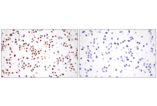 Immunohistochemistry Image 3: Chk2 (1C12) Mouse mAb (BSA and Azide Free)