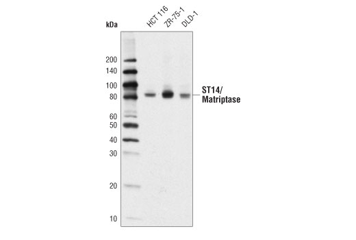 Western Blotting Image 1: ST14/Matriptase Antibody