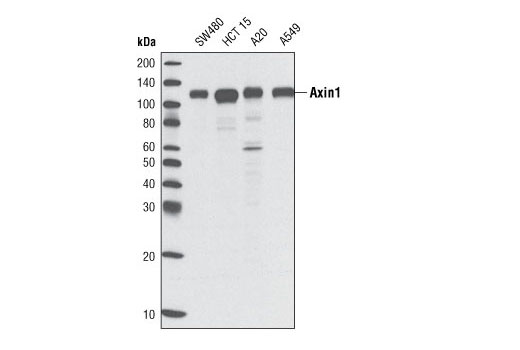  Image 2: Wnt Signaling Antibody Sampler Kit
