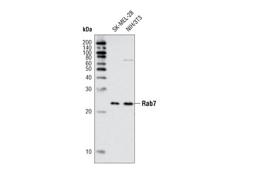 Western Blotting Image 1: Rab7 Antibody