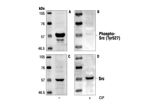 Western Blotting Image 1: Phospho-Src (Tyr527) Antibody