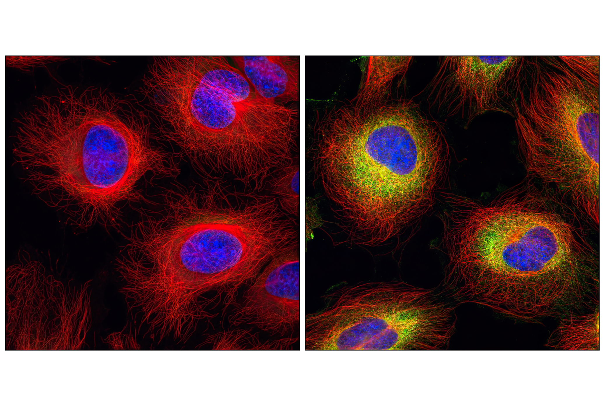 Immunofluorescence Image 1: β-Tubulin (9F3) Rabbit mAb (Alexa Fluor® 555 Conjugate)
