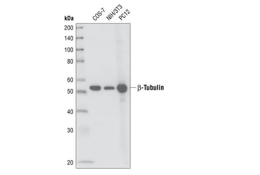  Image 6: Cytoskeletal Marker Antibody Sampler Kit