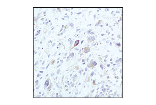  Image 13: Cytoskeletal Marker Antibody Sampler Kit