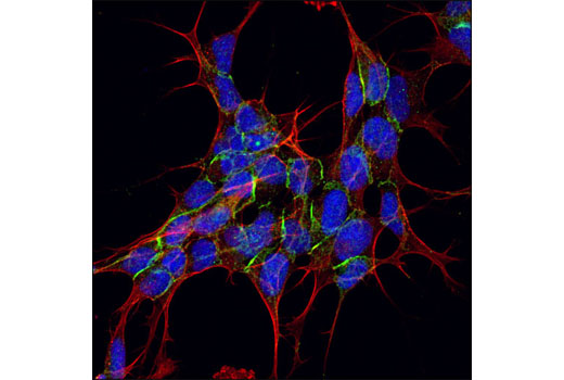 Immunofluorescence Image 1: α-N-Catenin Antibody